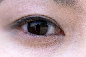 気持ちに正直に性交するためのパイプカット