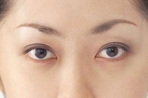 ボトックス注射なら「タカラヅカ・塩崎クリニック」